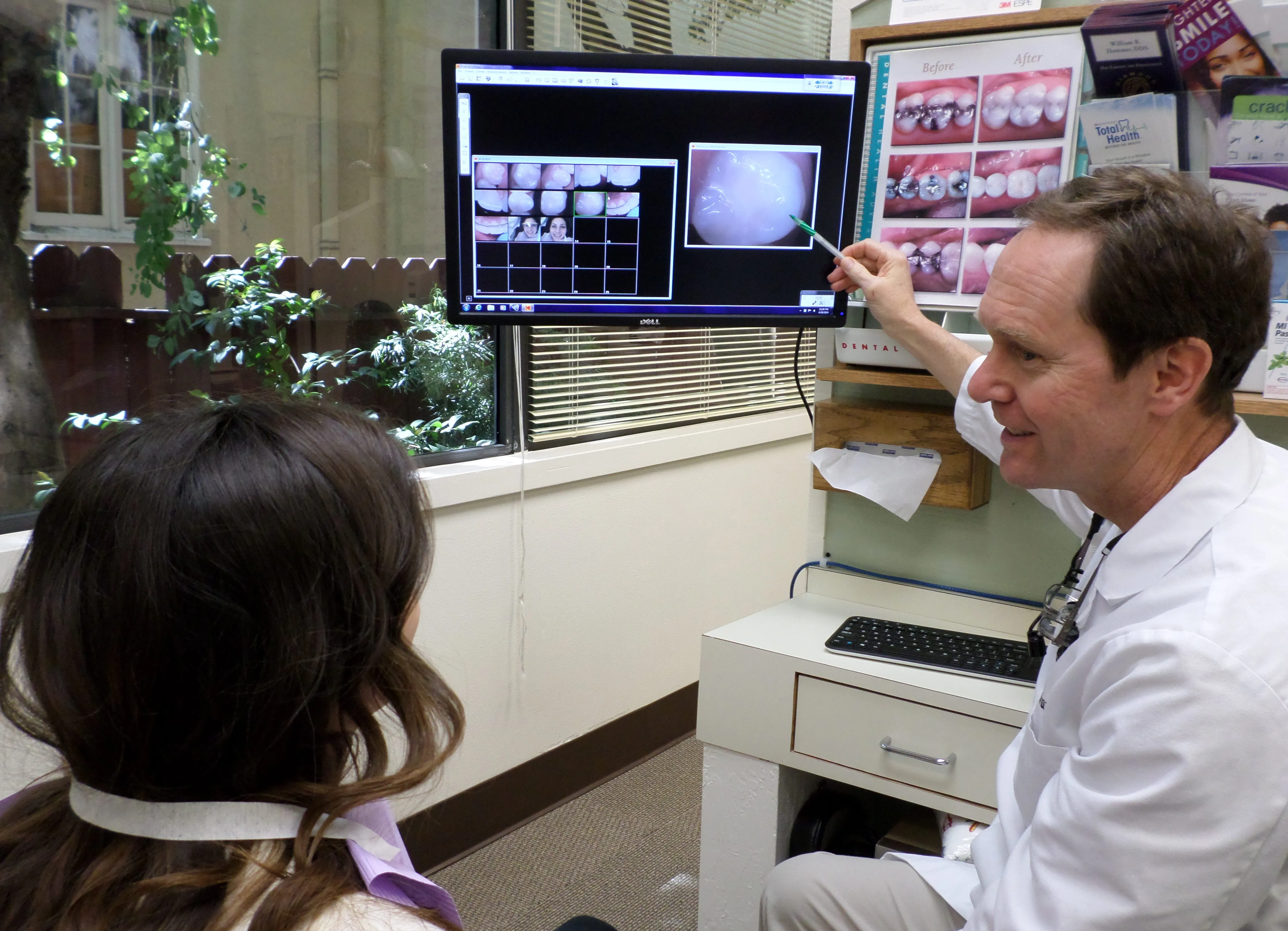 Smile Makeover: A Guide to Cosmetic and Restorative Procedures